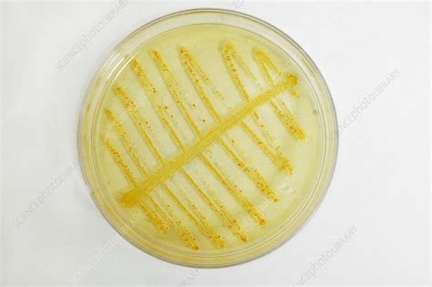 e.coli sampling.